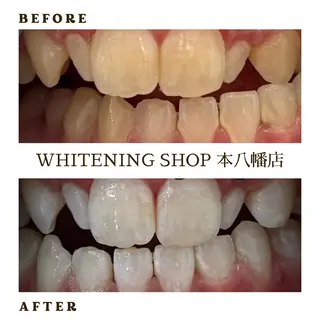 メンズ ホワイトニング ショップ本八幡店のエステ・リラクイメージ