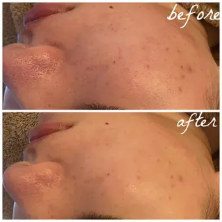 メンズ メナード岐阜市茜部 杉浦のエステ・リラクイメージ