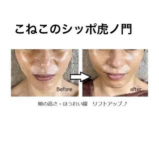 くびれ作り専門サロン こねこのシッポ虎ノ門のエステ・リラクイメージ