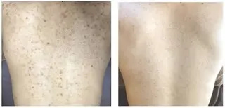 ほわいと あざぶのマツエク・マツパデザイン