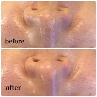 Salon de cheri サロンドシェリ人形町店所属・毛穴のお悩み・シミ 松本瞳のエステ・リラクイメージ