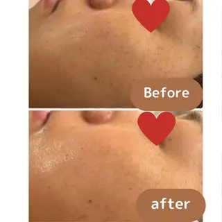 TWINKLE上尾店 Shimadaのエステ・リラクイメージ