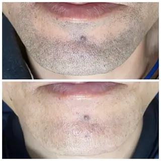 メンズ ヘアーサロンいしざわ所属・いしざわ /メンズ脱毛サロンのエステ・リラクイメージ