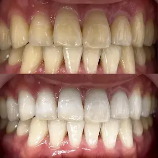 LBSホワイトニング 銀座店💎スタッフ峯のその他イメージ