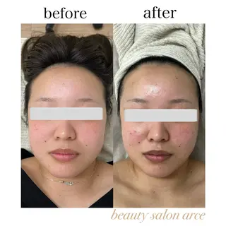 beauty salon arce所属・beauty salon arceのエステ・リラクイメージ