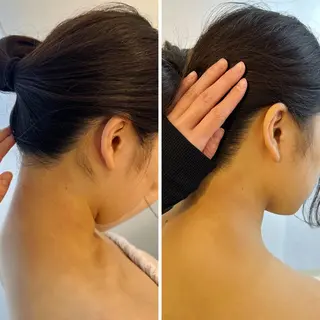 うなじ脱毛/美肌脱毛 LABELのエステ・リラクイメージ
