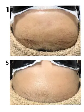 Laule'a ラウレアのエステ・リラクイメージ