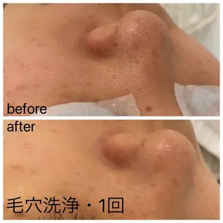 痛くない美肌脱毛 AZALEA本厚木店のエステ・リラクイメージ