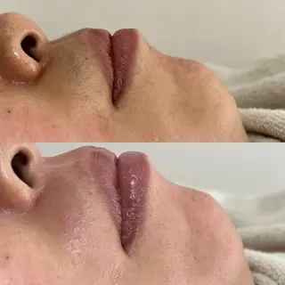 Rejue所属・永田 茜のエステ・リラクイメージ