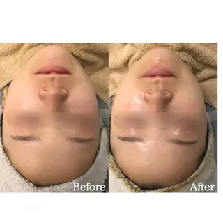 肌質改善サロン BestBelleのエステ・リラクイメージ