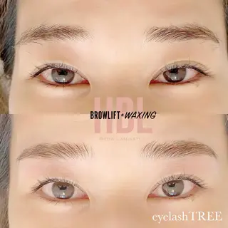 マツエク・マツパ まつげ、毛穴 TREEのエステ・リラクイメージ