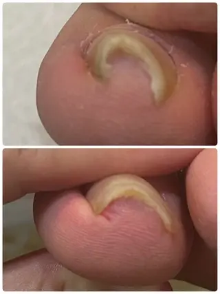 ネイル 東洋美療　よつば所属・東洋美療 よつばのネイルデザイン