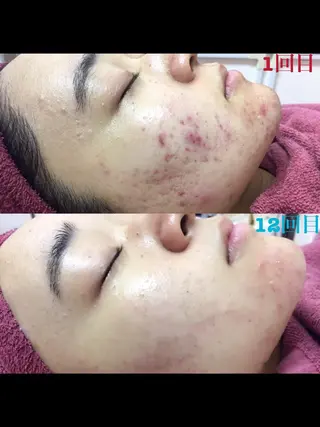 透明感の肌Lino malieのエステ・リラクイメージ