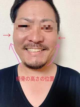 痩身/脱毛/ネイル HARUKAのエステ・リラクイメージ