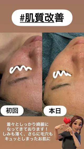 LiZA エステティックサロンのエステ・リラクイメージ