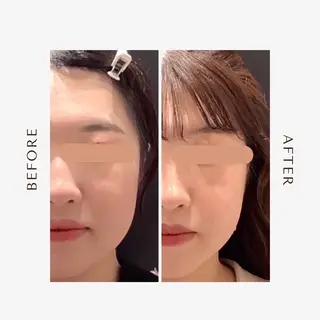 最速小顔・肌質管理 espoirマキのエステ・リラクイメージ