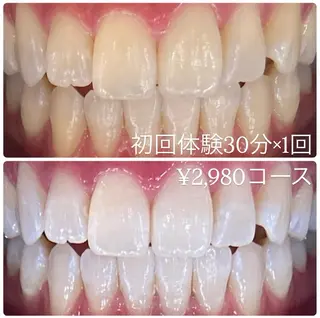 PLATINUM Beauty 横浜店所属・ホワイトニングルーム 横浜店のその他イメージ