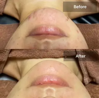 メンズ キッズ 美肌・リラクゼーションサロンLu,Mie所属・美肌と癒しのサロン Lu,Mieのエステ・リラクイメージ