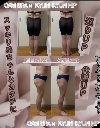 ヴィーナス ビューティーのエステ・リラクイメージ