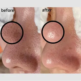 韓国肌管理 【毛穴専科】のエステ・リラクイメージ