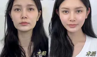 ネイル aliaハイフ&水光ジェットサロン所属・aliaハーブ水光店 エステティシャン募集のエステ・リラクイメージ