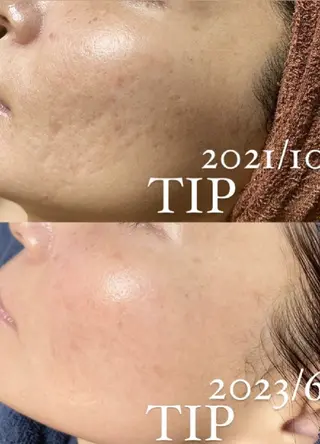 Ellebeauty relaxationのエステ・リラクイメージ