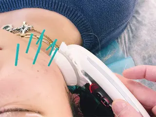 小顔美容鍼専門サロン 渋谷YZのその他イメージ