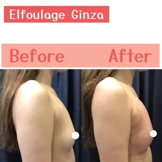 エルフラージュ 銀座店のエステ・リラクイメージ