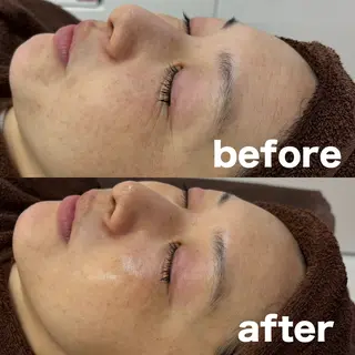 肌質改善 陶器肌🌿のエステ・リラクイメージ