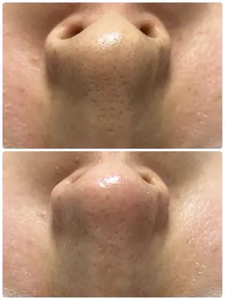 MOOR／ nanamiのマツエク・マツパデザイン