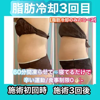 痩身/脱毛/ネイル HARUKAのエステ・リラクイメージ