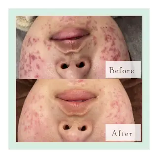 ホワイトニングショッ 吉祥寺2号店のエステ・リラクイメージ