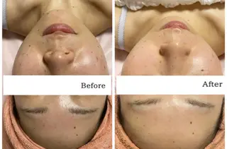 EYE LASH LAPISのエステ・リラクイメージ