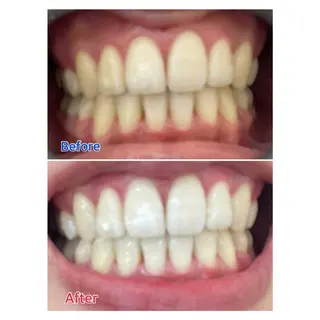 MBEAUTYSALON 千葉店・京成大久保所属・Melty 輝のその他イメージ