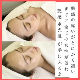 美容鍼灸サロン mahoroba院長のエステ・リラクイメージ