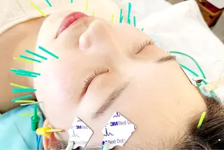 小顔美容鍼専門サロン 渋谷YZのエステ・リラクイメージ