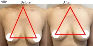 光フォト美容 エイジング、敏感肌のエステ・リラクイメージ