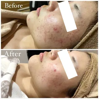 ハーブピーリング専門 muro.のエステ・リラクイメージ