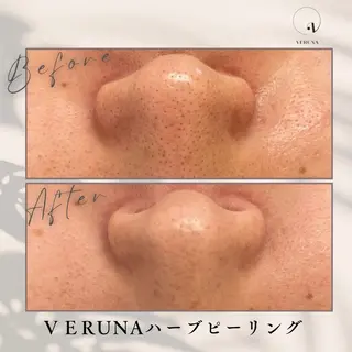 ニキビ改善専門店 d'Albaのエステ・リラクイメージ