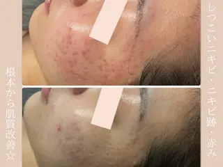 Monart -deux-のエステ・リラクイメージ