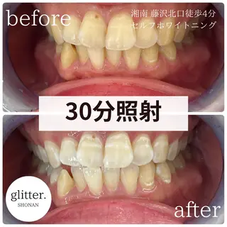 glitter.SHONAN所属・佐久間 茉弥のエステ・リラクイメージ