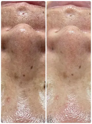 beauty salon  SUKOBI所属・ﾋﾞｭｰﾃｨｻﾛﾝ SUKOBIのエステ・リラクイメージ