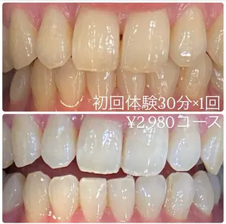 PLATINUM Beauty 横浜店所属・ホワイトニングルーム 横浜店のその他イメージ