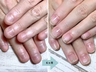 ネイル 深爪矯正・自爪育成 ネイルサロンアモここのネイルデザイン