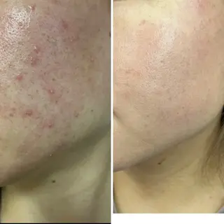 mison所属・mison 安形友花のネイルデザイン