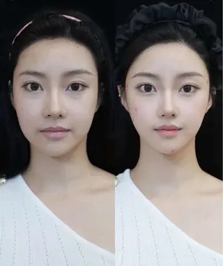 マツエク・マツパ aliaハイフ&水光ジェットサロン所属・aliaハーブ水光店 エステティシャン募集のエステ・リラクイメージ