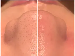 NAVI 韓国肌管理所属・NAVI韓国肌管理《 毛穴/艶肌/小顔》のエステ・リラクイメージ