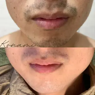 メンズ シードリン 府内店 小波のエステ・リラクイメージ