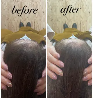 ate'所属・個室ドライヘッドスパ 🍃moriのエステ・リラクイメージ