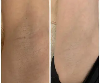 ララ/ハーブ メゾンリュバンのエステ・リラクイメージ